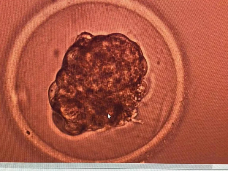 Embryo development observed in a fertility laboratory