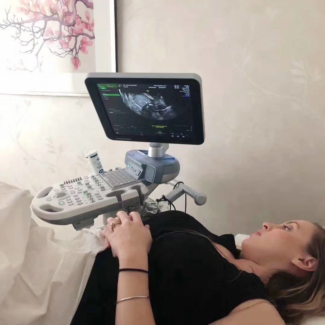 A surrogate attending an ultrasound appointment